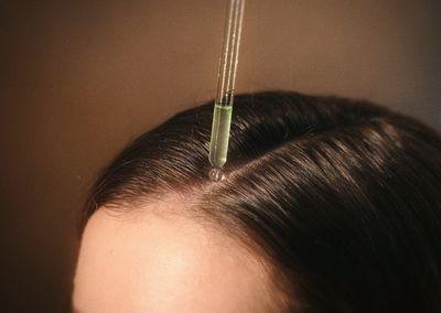 用错等于白擦!养发头皮精华4个重点必看 这样才有效